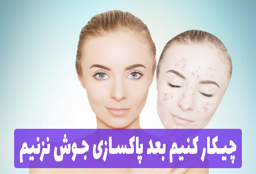 چیکار کنیم بعد پاکسازی جوش نزنیم